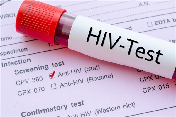 Tabipler birliği HIV testlerinin gerekliliğine vurgu yaptı