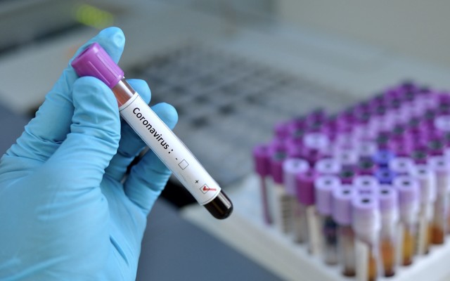 ABD’de 5 dakikada sonuç veren “Koronavirüs Test Kiti” geliştirildi