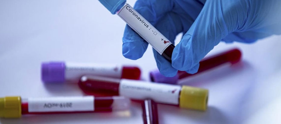 İki toplumlu Sağlık Teknik Komitesi “Coronavirüs” gündemiyle toplandı