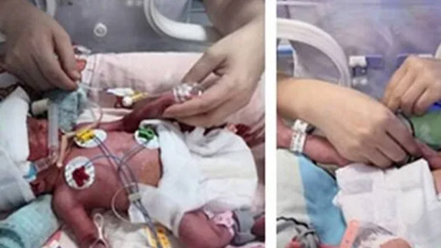 Çin’de bir kadın üç kez düşük yaptıktan sonra dördüz doğurdu
