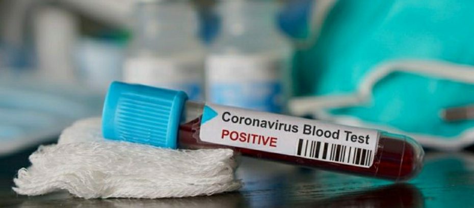 Güney'de 3314 test yapıldı 11 yeni Koronavirüs pozitif vakaya rastlandı