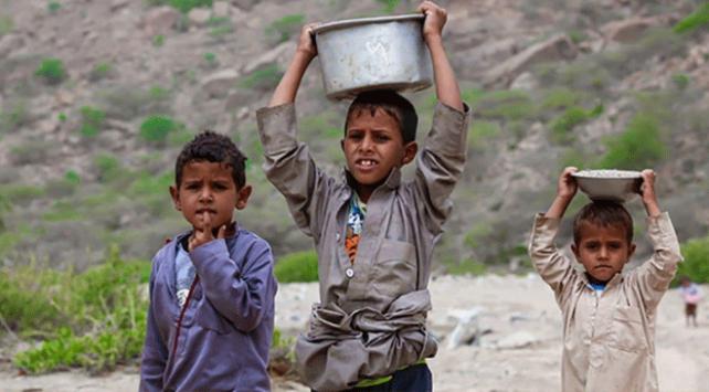 Yemen’de 100 bin çocuk açlıktan ölebilir