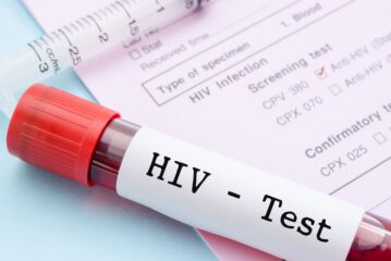 Güney'de AIDS’e neden olan HIV-1 virüsüne ilişkin 4 yeni rekombinant varyant keşfedildi