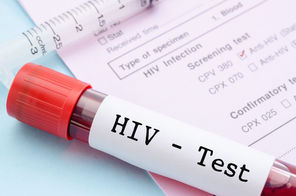 Güney’de AIDS’e neden olan HIV-1 virüsüne ilişkin 4 yeni rekombinant varyant keşfedildi