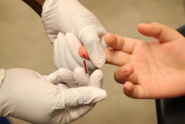 Güney Kıbrıs'ta bin 500'den fazla HIV taşıyıcısı